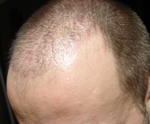 index.php/fa/2601/0/