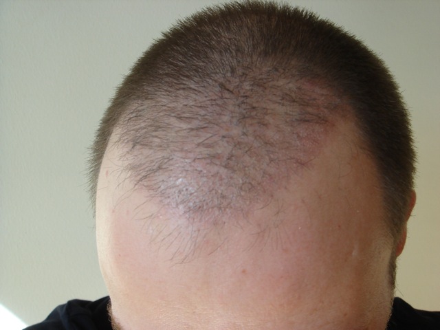 index.php/fa/2602/0/