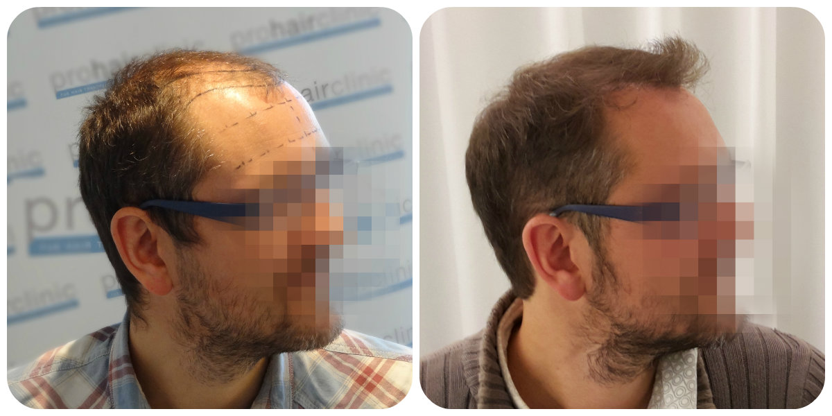 index.php/fa/26148/0/