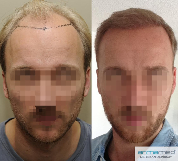 index.php/fa/26199/0/