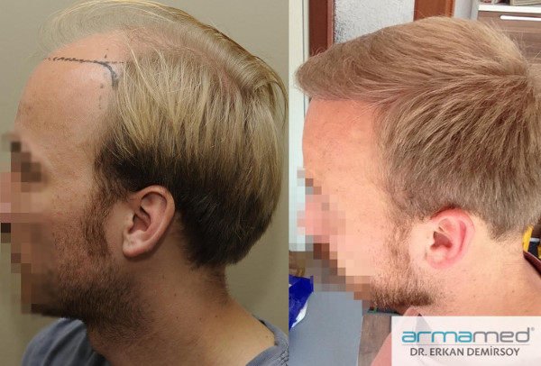 index.php/fa/26201/0/