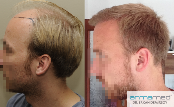 index.php/fa/26202/0/