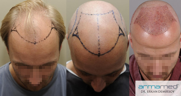 index.php/fa/26205/0/