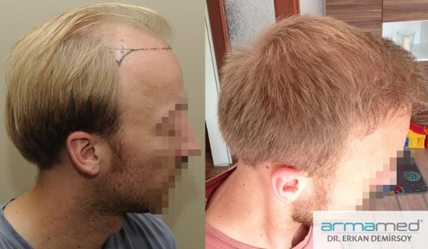 index.php/fa/26207/0/