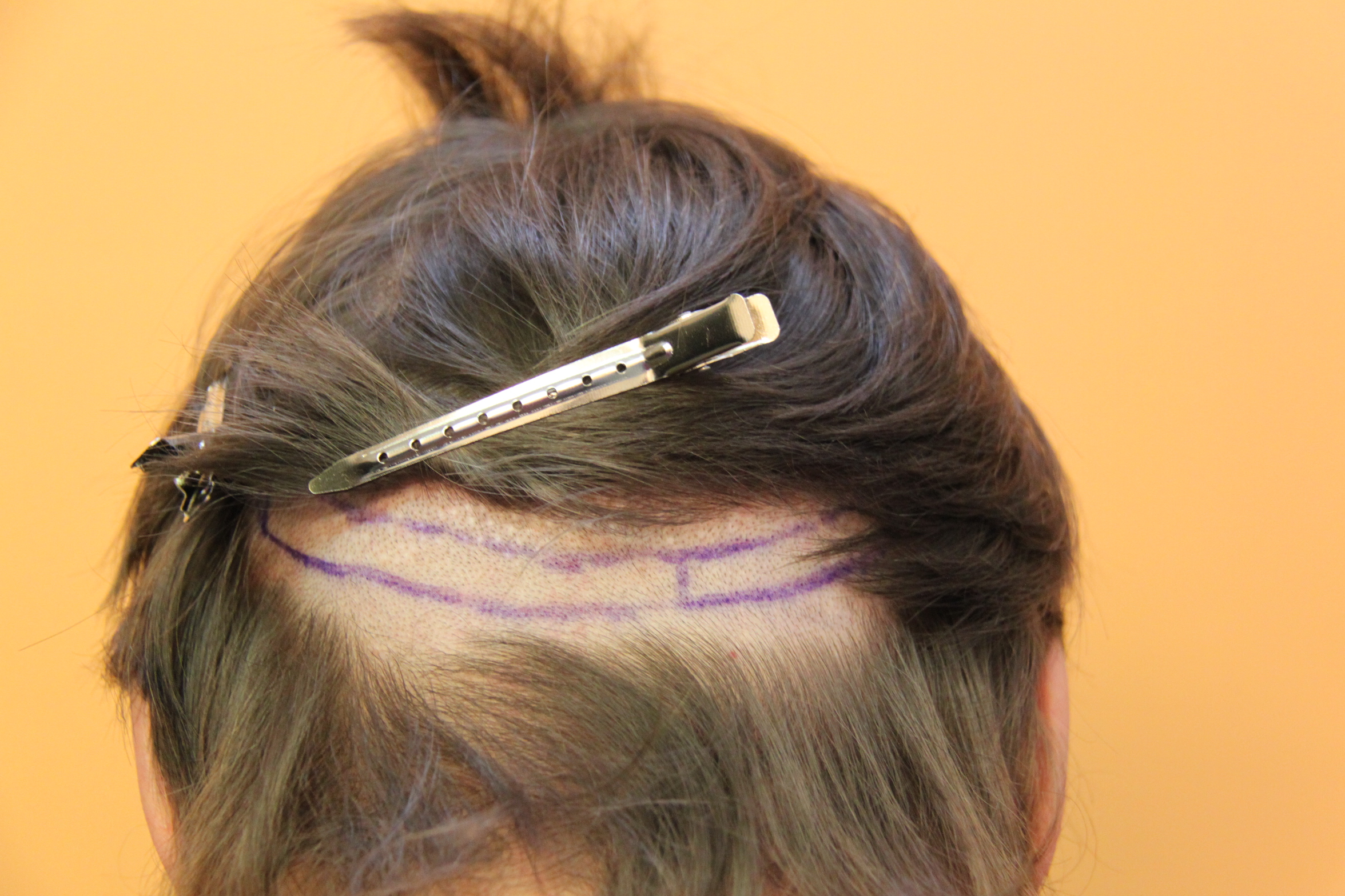 index.php/fa/26222/0/