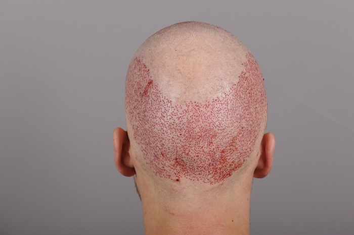 index.php/fa/26230/0/