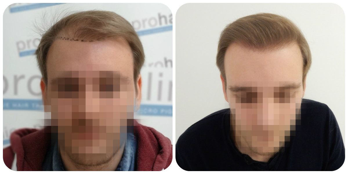 index.php/fa/26292/0/