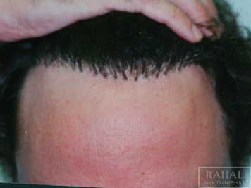 index.php/fa/2638/0/