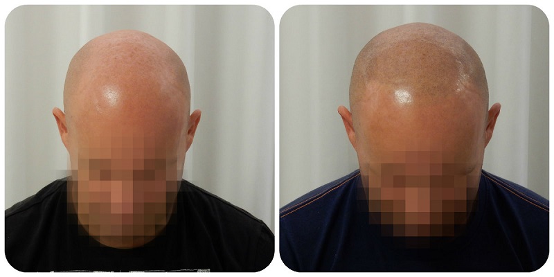 index.php/fa/26471/0/