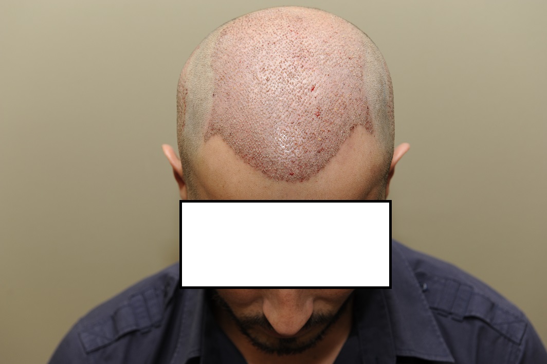 index.php/fa/27224/0/