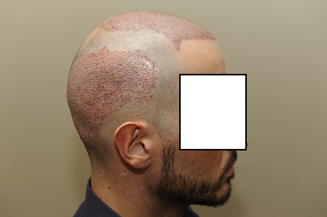 index.php/fa/27225/0/