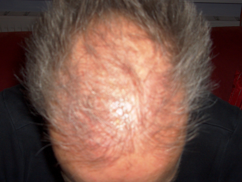 index.php/fa/2723/0/