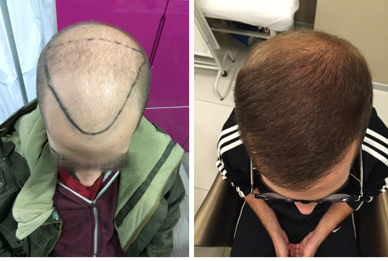 index.php/fa/27233/0/