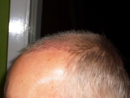 index.php/fa/2729/0/