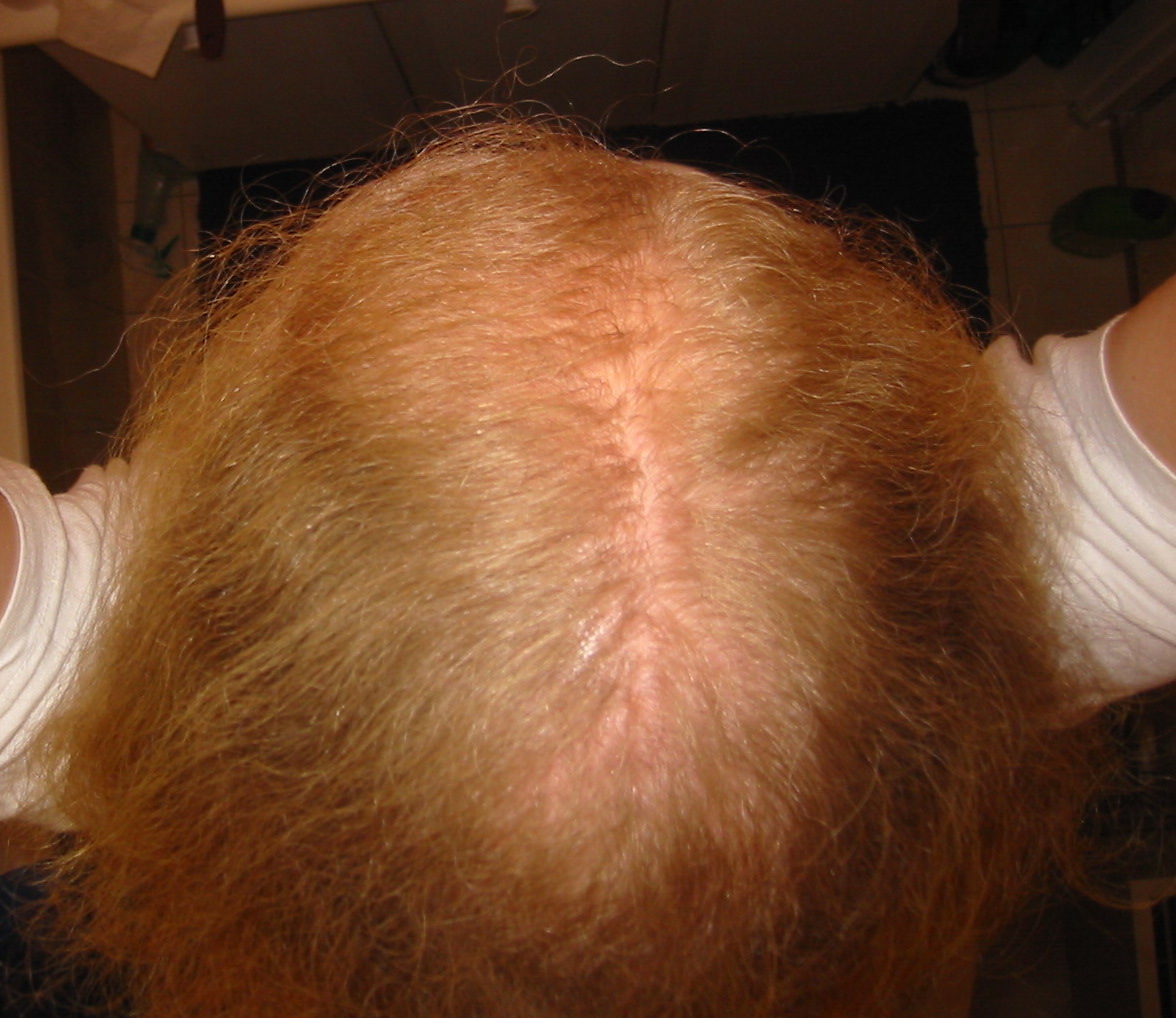 index.php/fa/2776/0/