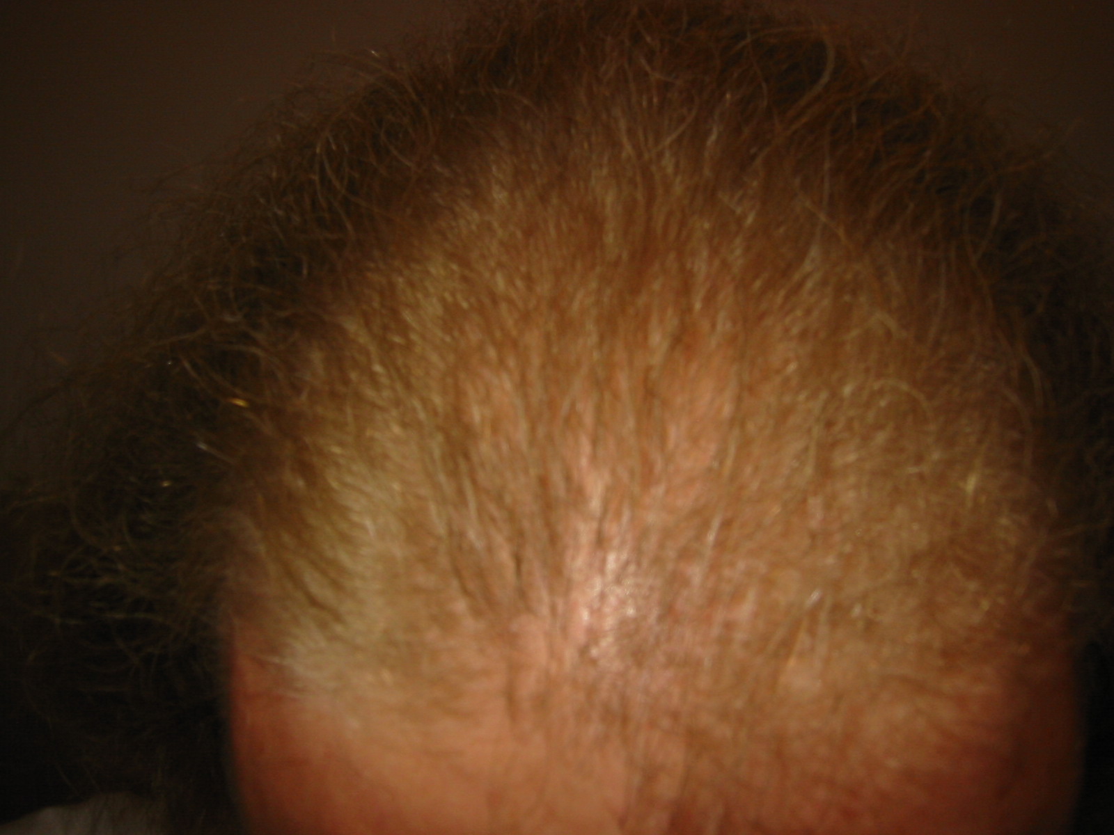 index.php/fa/2777/0/