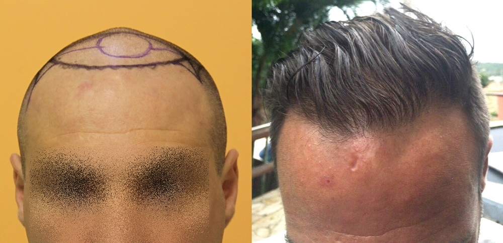 index.php/fa/27774/0/