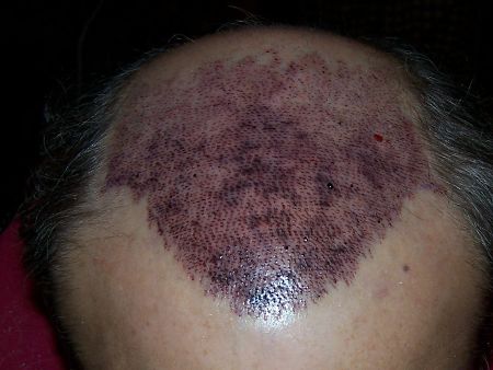 index.php/fa/2779/0/