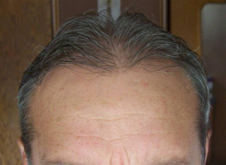 index.php/fa/2781/0/