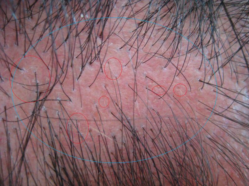 index.php/fa/2799/0/