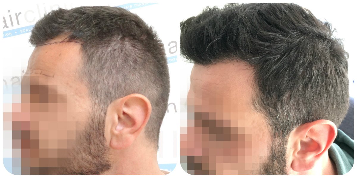 index.php/fa/28463/0/