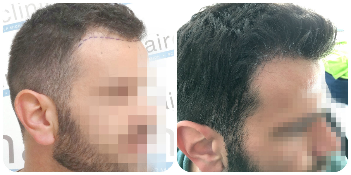 index.php/fa/28464/0/