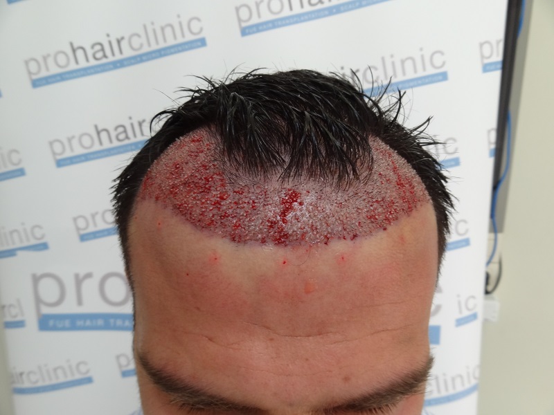 index.php/fa/28467/0/