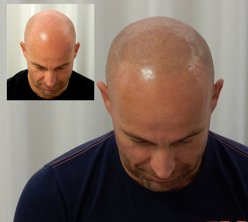 index.php/fa/28468/0/