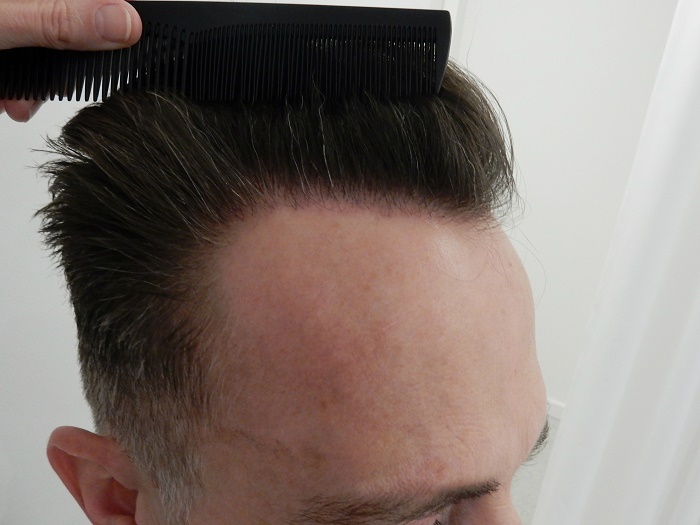 index.php/fa/28513/0/