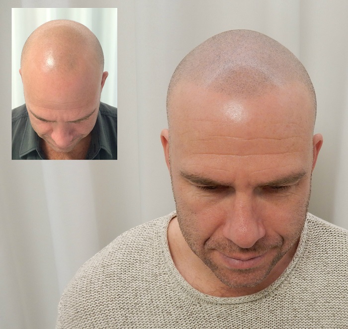 index.php/fa/28515/0/