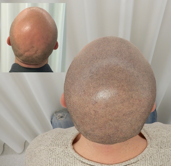 index.php/fa/28516/0/