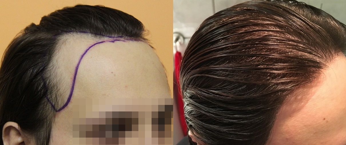 index.php/fa/28546/0/