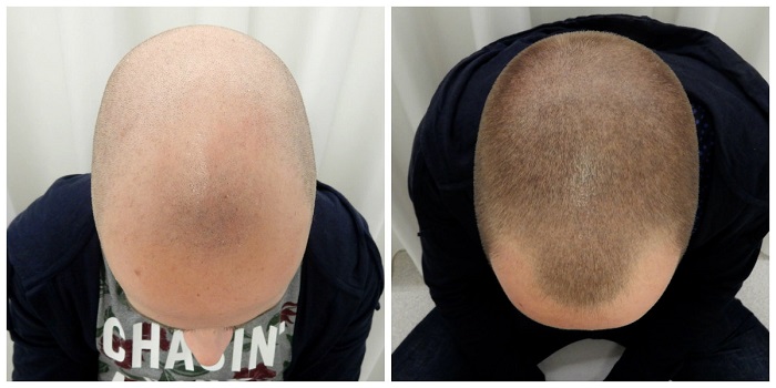 index.php/fa/28610/0/