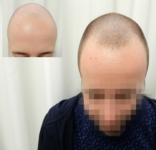 index.php/fa/28644/0/