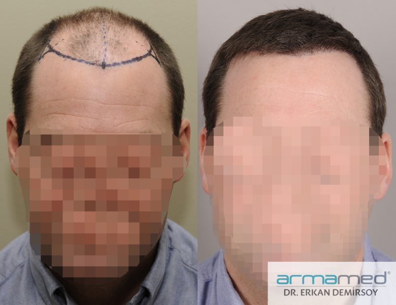 index.php/fa/28676/0/