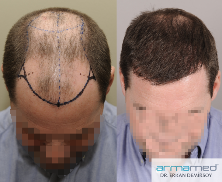 index.php/fa/28677/0/