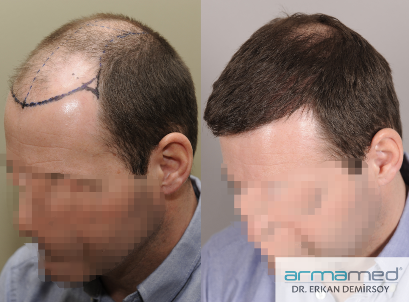 index.php/fa/28679/0/