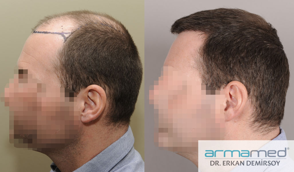 index.php/fa/28680/0/