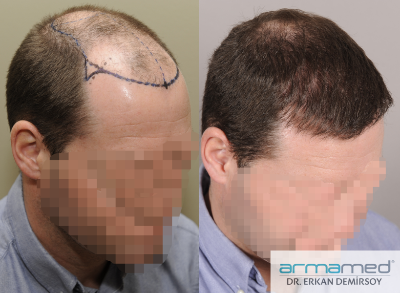 index.php/fa/28681/0/