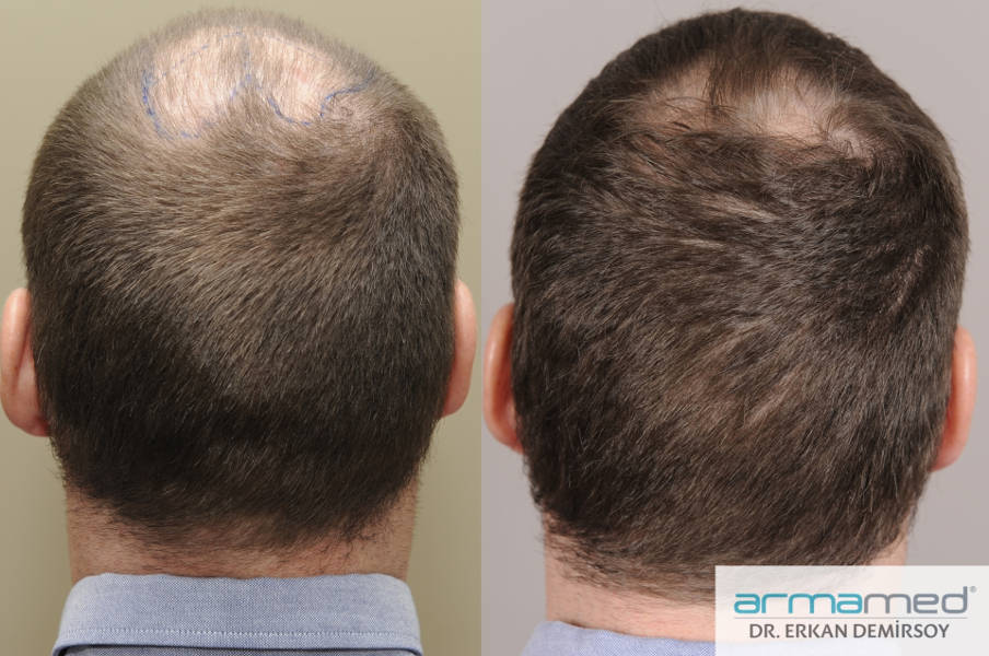 index.php/fa/28683/0/