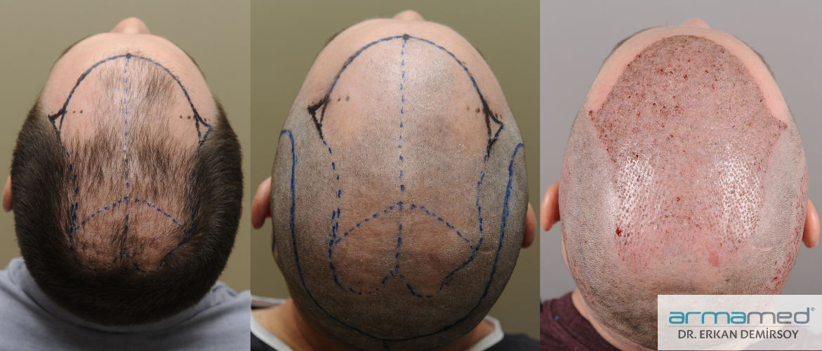 index.php/fa/28684/0/