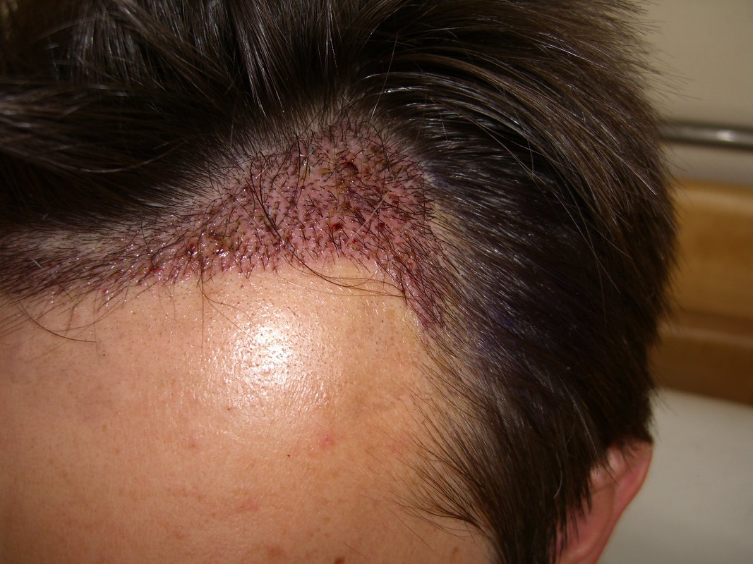 index.php/fa/2870/0/