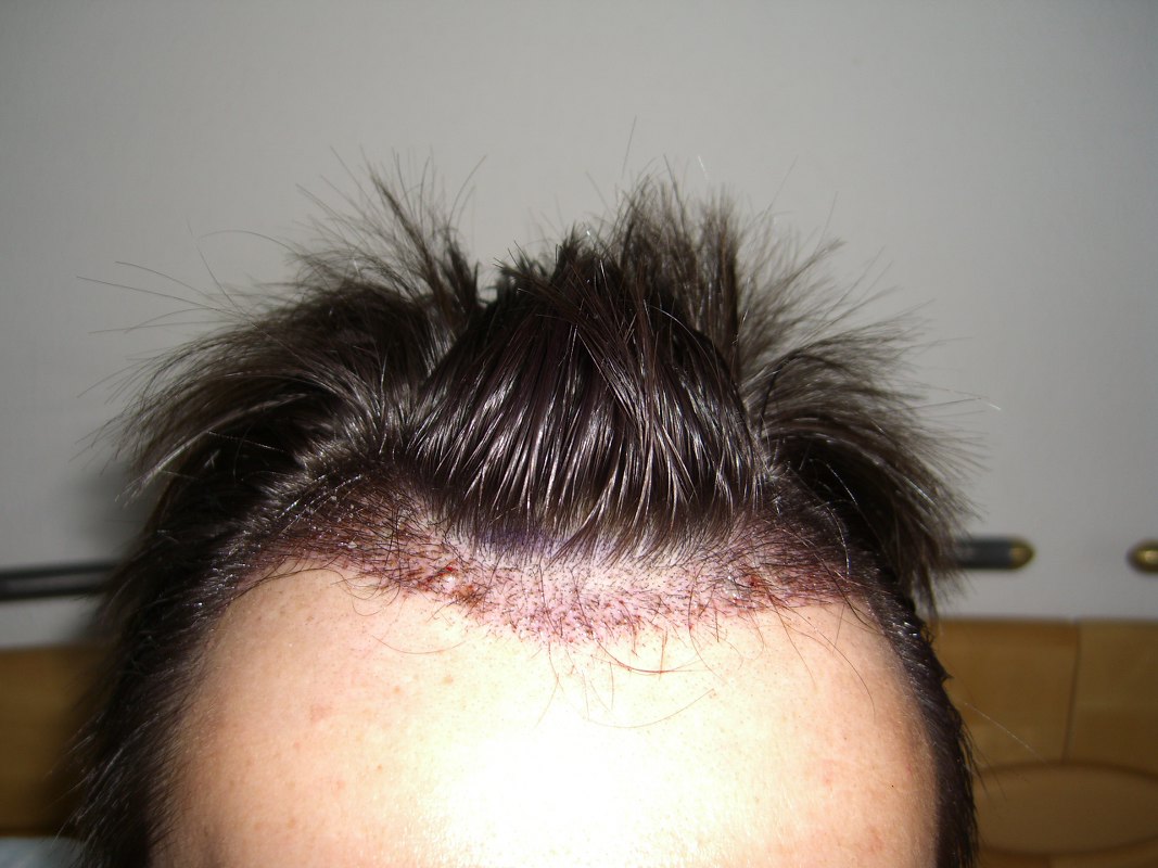 index.php/fa/2901/0/