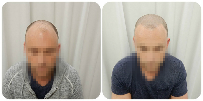 index.php/fa/29034/0/