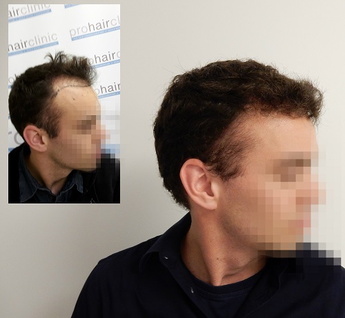 index.php/fa/29170/0/