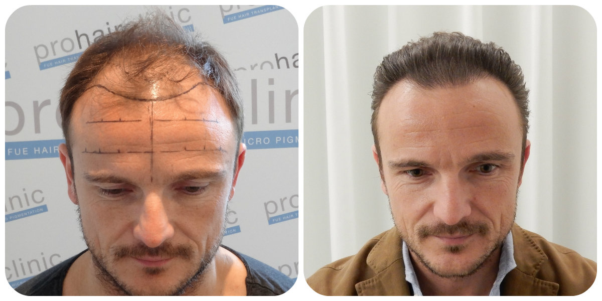 index.php/fa/29177/0/