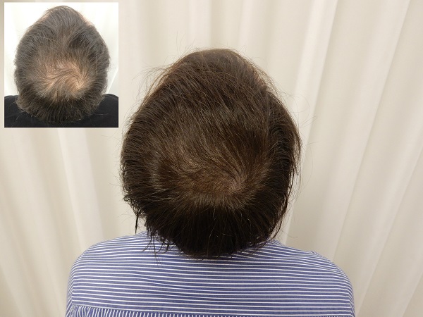 index.php/fa/29196/0/