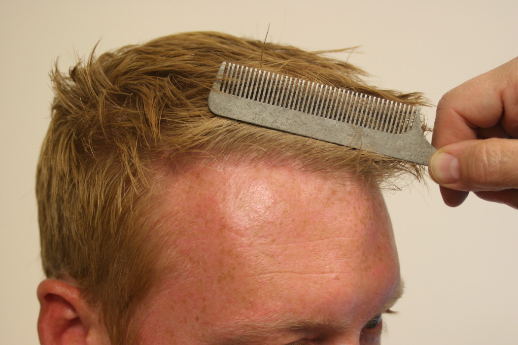 index.php/fa/2933/0/