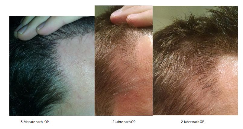 index.php/fa/29424/0/