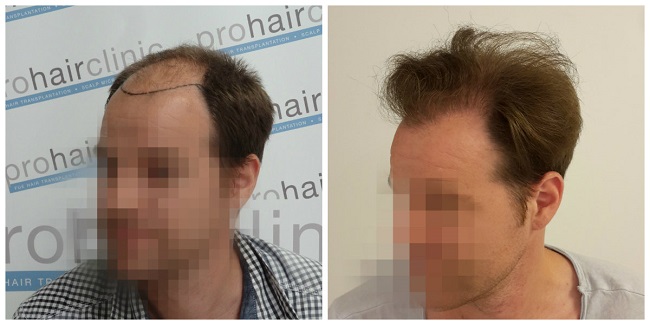 index.php/fa/29676/0/